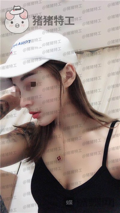 上海艺星,李建兵,隆鼻,案例,价格,