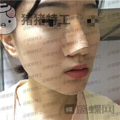 武汉华美,马行,,案例,价格,