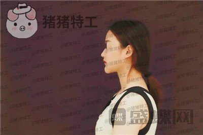 福州爱美尔,张胜利,,案例,价格,