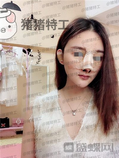 福州爱美尔,张胜利,,案例,价格,