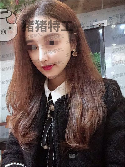 福州爱美尔,张胜利,,案例,价格,