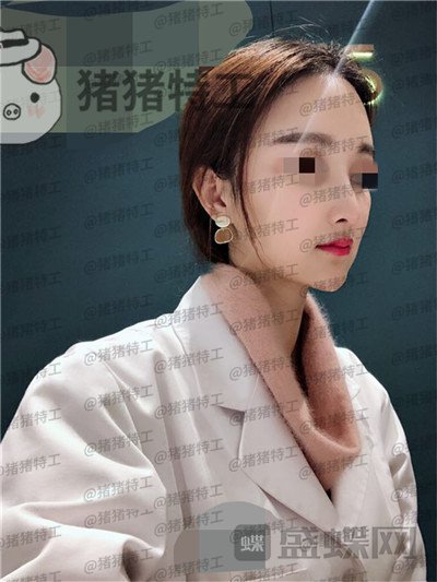 福州爱美尔,张胜利,,案例,价格,