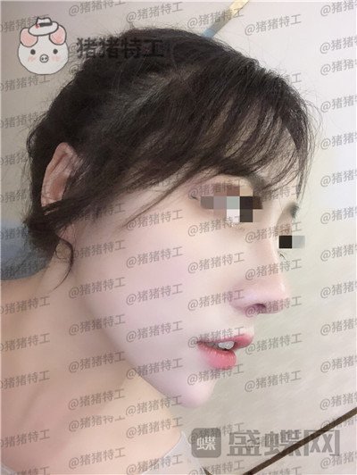 云南华美美莱,洪晓娅,,案例,价格,