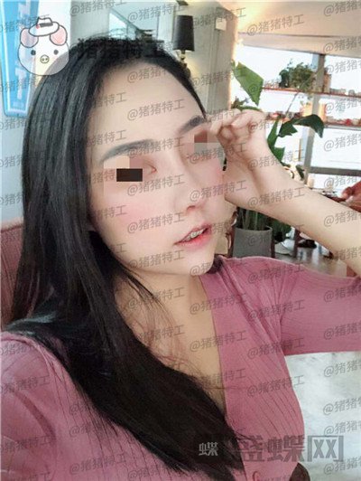 云南华美美莱,洪晓娅,,案例,价格,