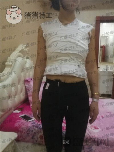 北京英煌项力源隆胸案例价格分享，不仅增大还改良掉下垂真的太惊讶啦！