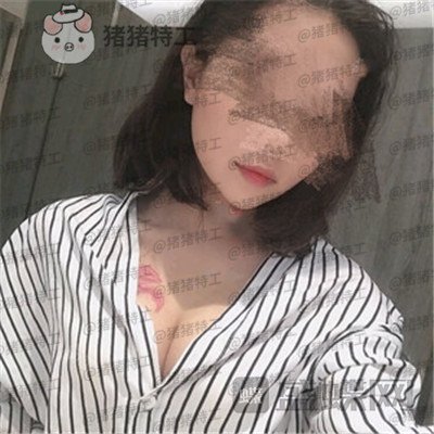 上海美贝尔金关键隆胸案例价格分享,衣显瘦脱衣有肉走路回头率都变高了~