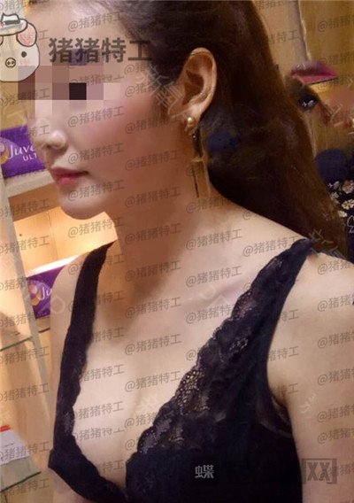 郑州集美刘德辉隆胸案例价格分享，这么好看的胸型真的是婚姻的调味剂~