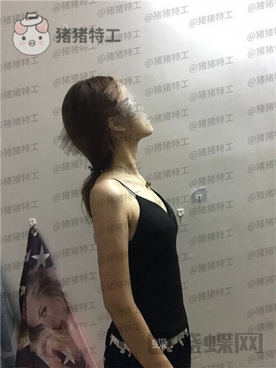 重庆新铜雀台鹏隆胸案例价格分享,好看的胸真的是生活的调节剂!