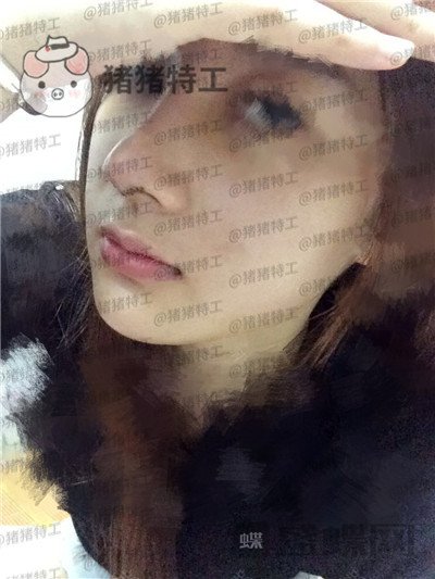 南宁美丽焦点,焦俊光,,隆鼻,案例,价格,