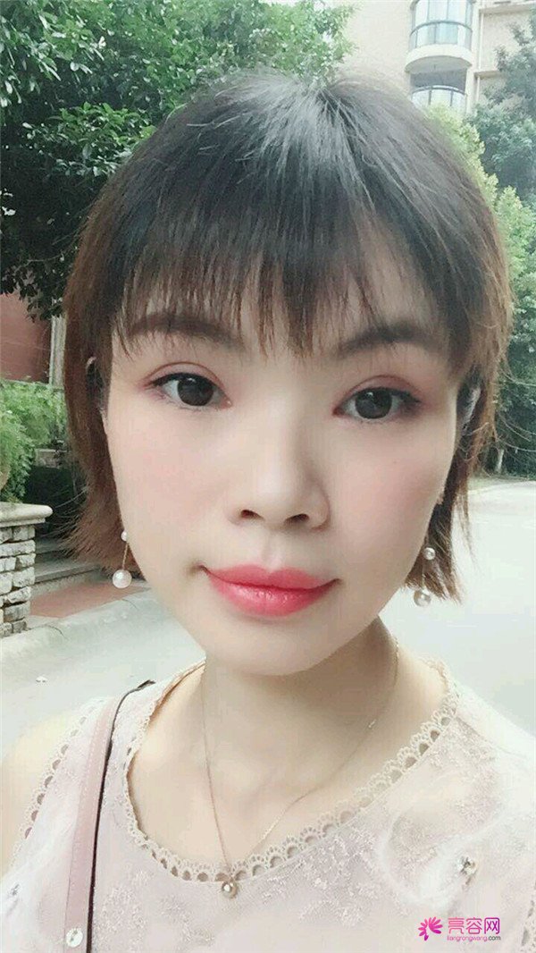 重庆双眼皮案例分享,能有这样的果也是很好看了,安排!!!!