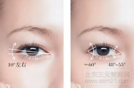 内外眦连线与水平夹角(10°左右) 内外眦连线与水平夹角(10°左右)