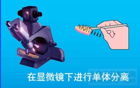 FUT单体毛囊植发第四步 FUT单体毛囊植发第四步