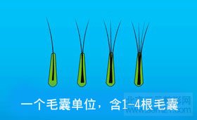 FUT单体毛囊植发第十步 FUT单体毛囊植发第十步