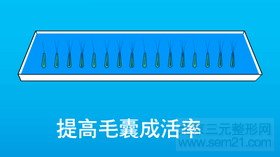FUT单体毛囊植发第六步 FUT单体毛囊植发第六步