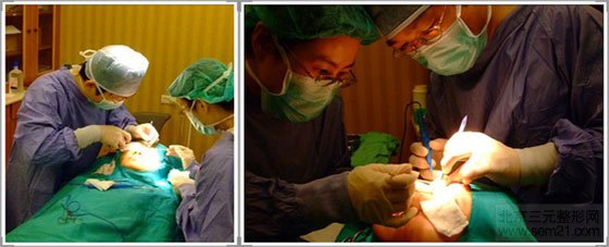 副乳吸脂手术中 副乳吸脂手术中