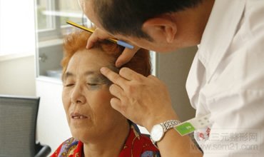 皮肤磨削治太田痣 怎样去太田痣,哪家医院好?