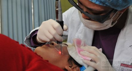 E光调节太田痣手术中 怎样去太田痣,哪家医院好?