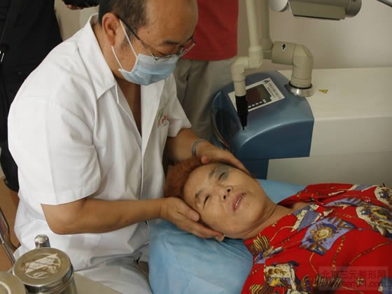 皮肤磨削治太田痣中 怎样去太田痣,哪家医院好?