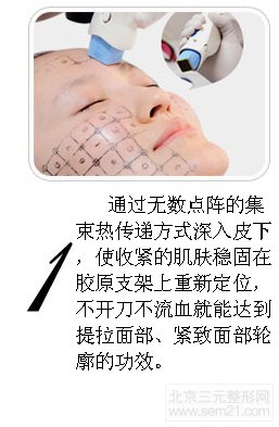 北京华韩整容医院虞守辉面部年轻除皱怎么样?