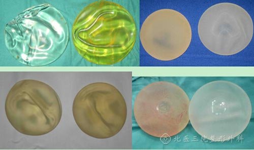 北京大学第三医院李比吸脂隆胸价格？案例图？