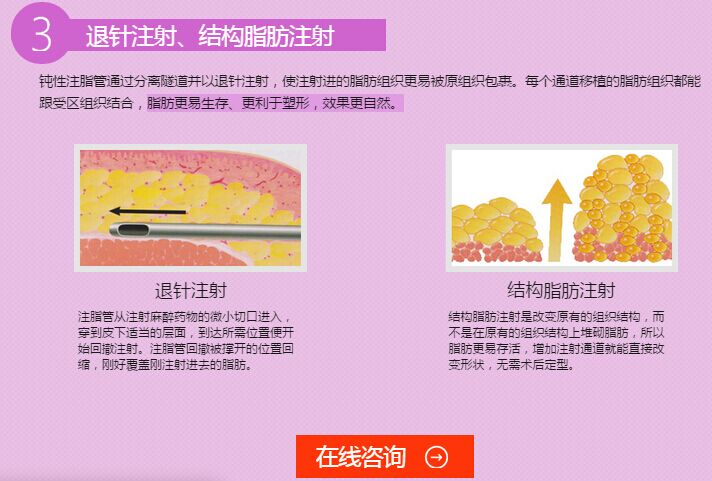 上海华美袁玉坤吸脂整形 上海华美袁玉坤自体脂肪隆胸多少钱?好吗?