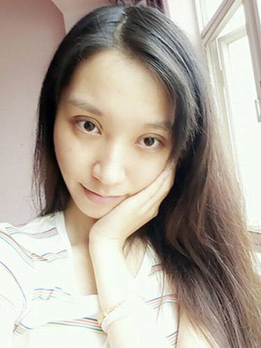 双眼皮+去脂肪的案例分享