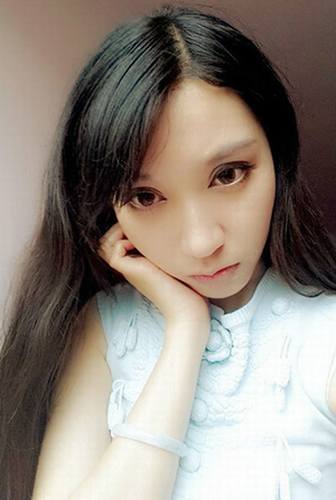 双眼皮+去脂肪的案例分享