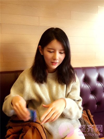 鼻中隔软骨隆鼻,脂肪填充术后8个月