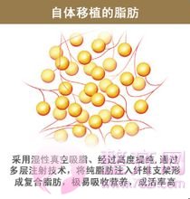 超小脂肪颗粒在面部年轻化的应用