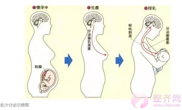 假体隆胸会影响哺乳吗?