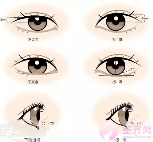 眼部整形四个方向无短板才算