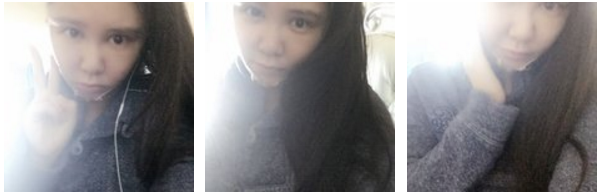 水动力面部吸脂