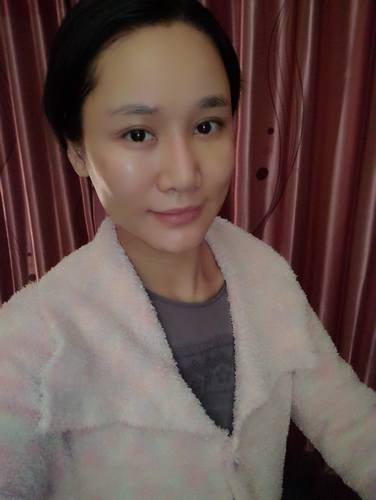 北京艺美王东做自体脂肪填充怎么样？多少钱？