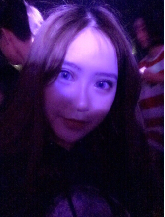 无锡丽都林院长做的双眼皮开眼角去皮去脂