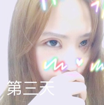 无锡丽都林院长做的双眼皮开眼角去皮去脂