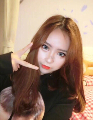 无锡丽都林院长做的双眼皮开眼角去皮去脂