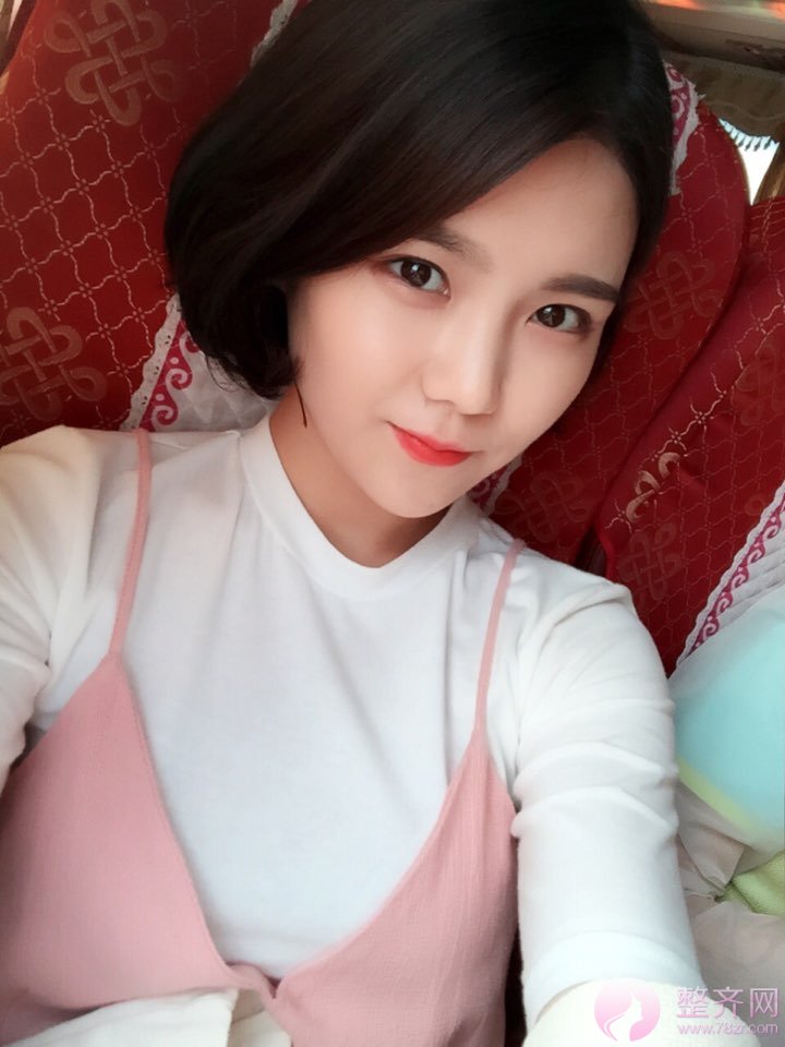 双眼皮+开眼角=电眼