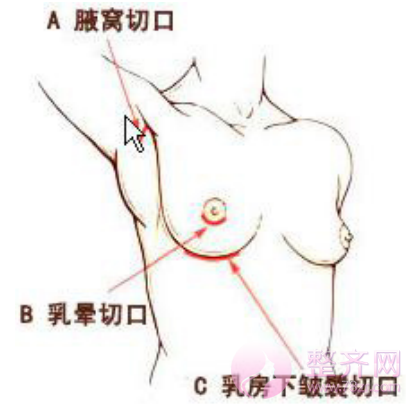 胸部符合哪些数据才好看呢?