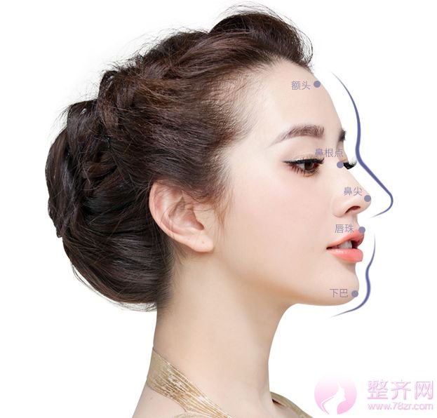 隆鼻≠综合隆鼻!你知道吗?