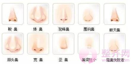 隆鼻≠综合隆鼻!你知道吗?