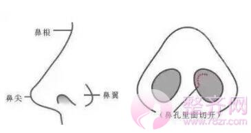 隆鼻≠综合隆鼻!你知道吗?