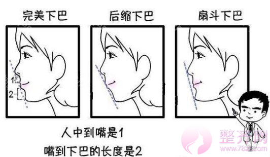 自体脂肪丰下巴,微小改良,巨大变化