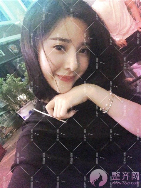 我的“香奈儿”韩式小翘鼻好看吗?get 到就炒鸡