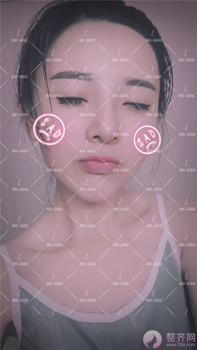 我的“香奈儿”韩式小翘鼻好看吗?get 到就炒鸡