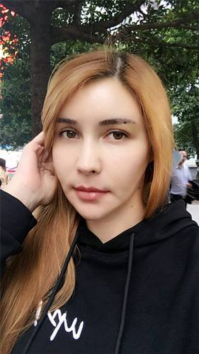 脂肪填充脸部的美丽日记【案例】