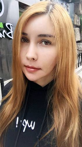 脂肪填充脸部的美丽日记【案例】