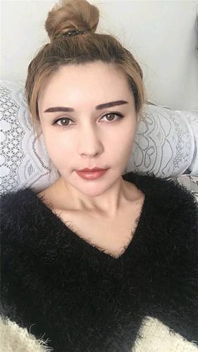 脂肪填充脸部的美丽日记【案例】