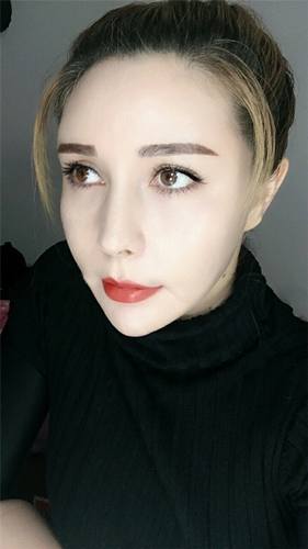 脂肪填充脸部的美丽日记【案例】