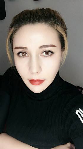 脂肪填充脸部的美丽日记【案例】