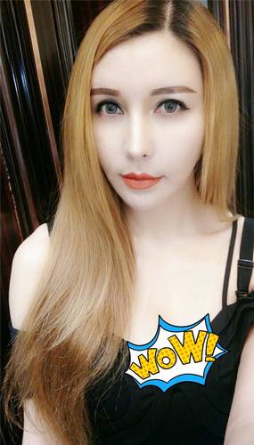 脂肪填充脸部的美丽日记【案例】